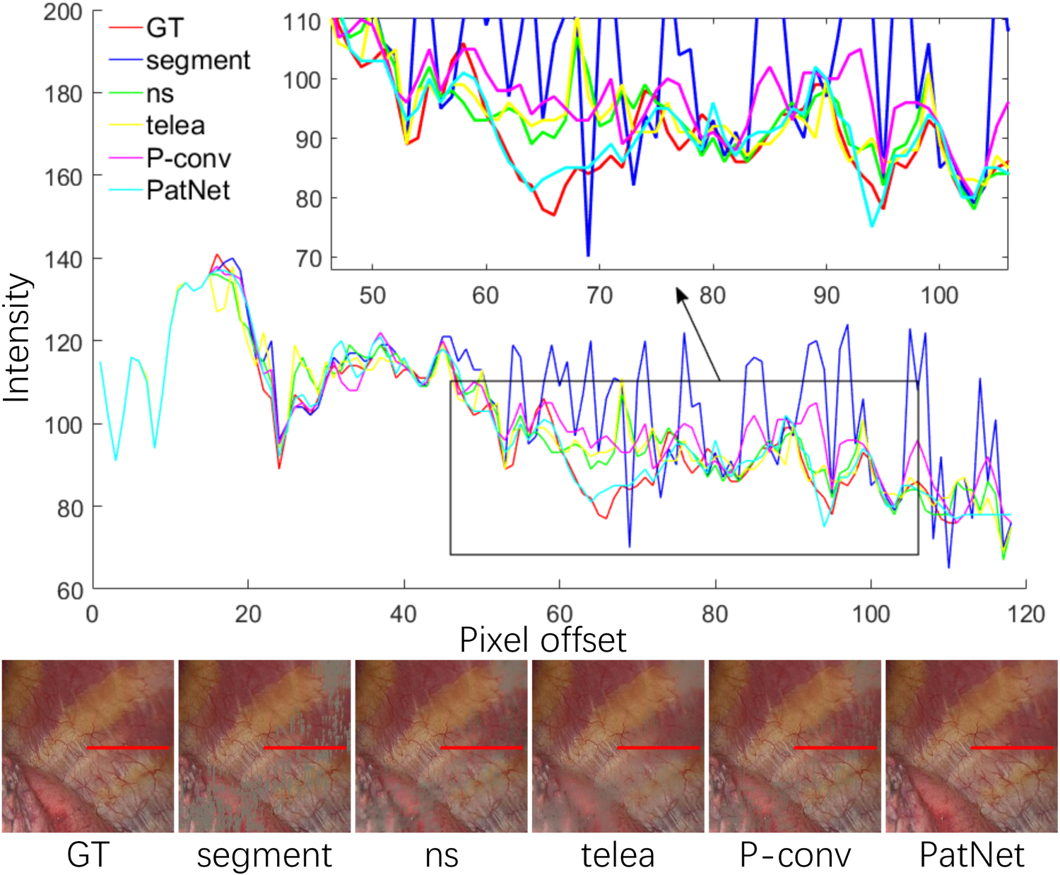 Specular highlight removal for endoscopic images using partial