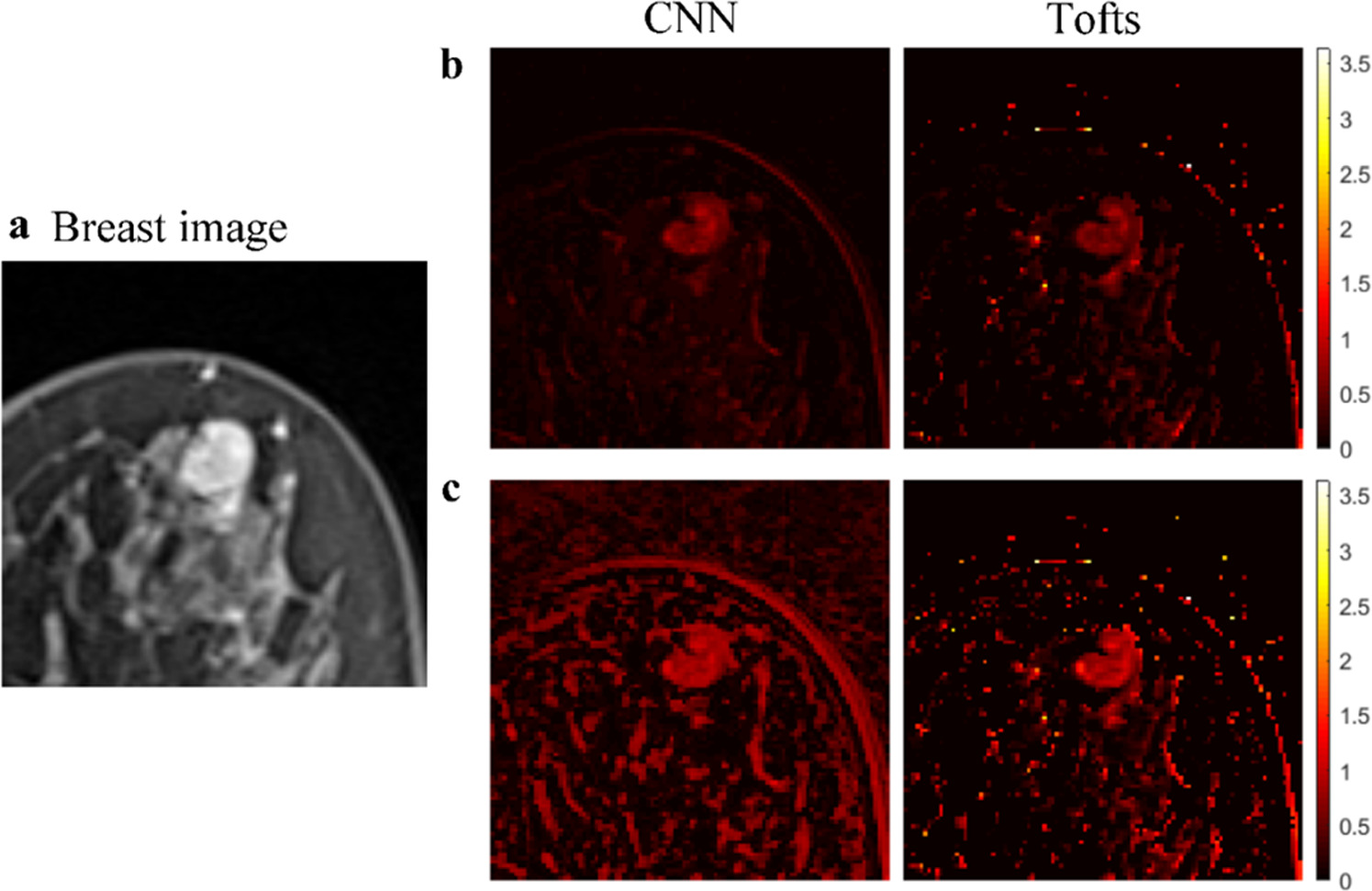 Efficient estimation of pharmacokinetic parameters from breast dynamic ...