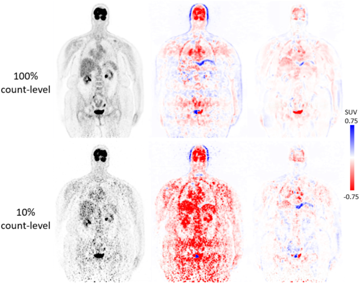 Deep learning-based attenuation map generation with simultaneously ...