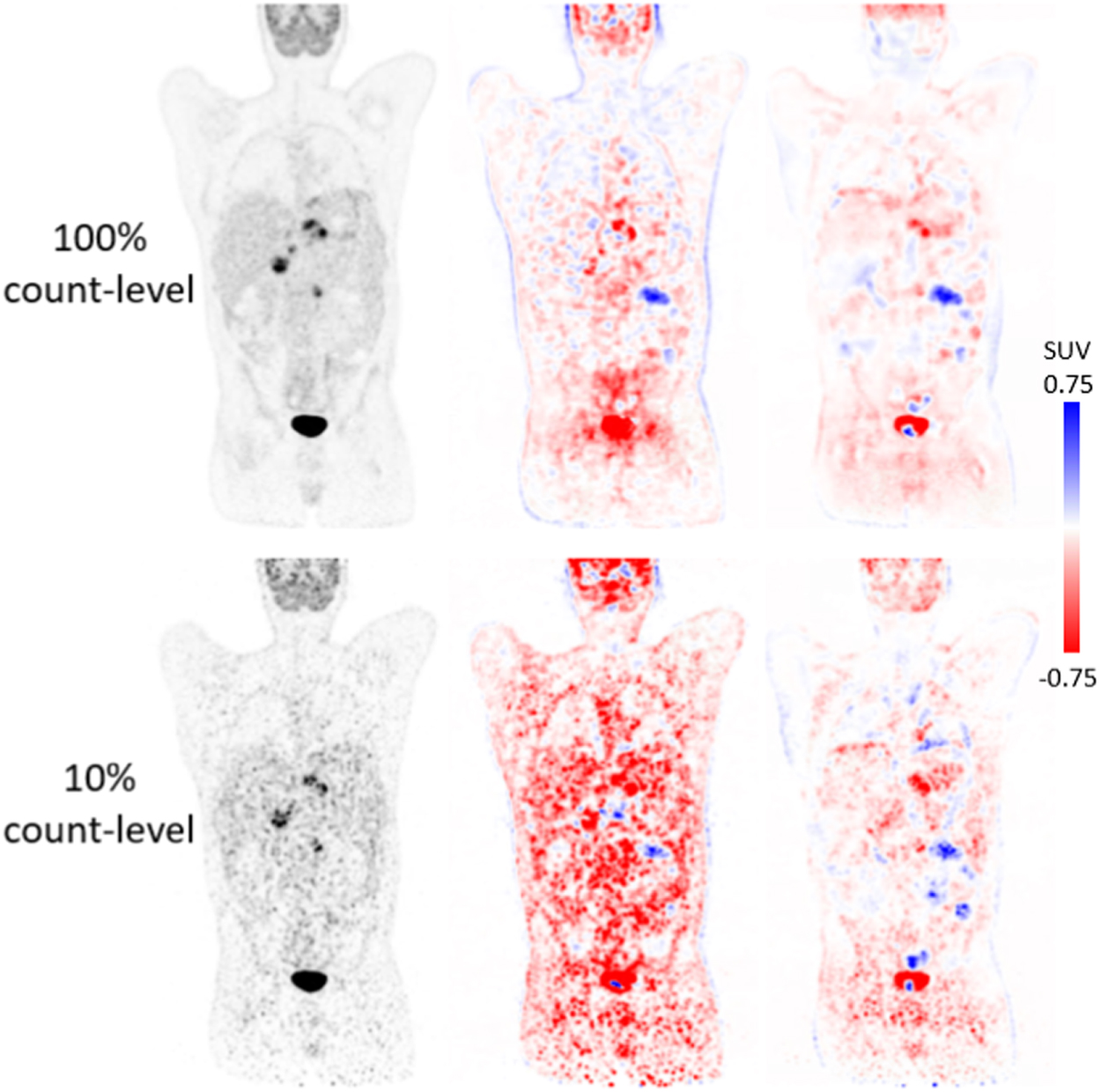Deep learning-based attenuation map generation with simultaneously ...