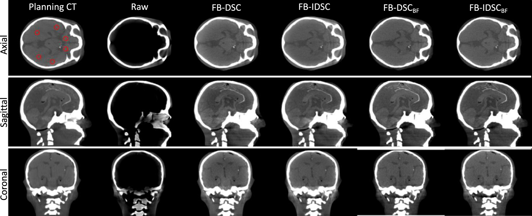 A practical and robust method for beam blocker-based cone beam CT ...