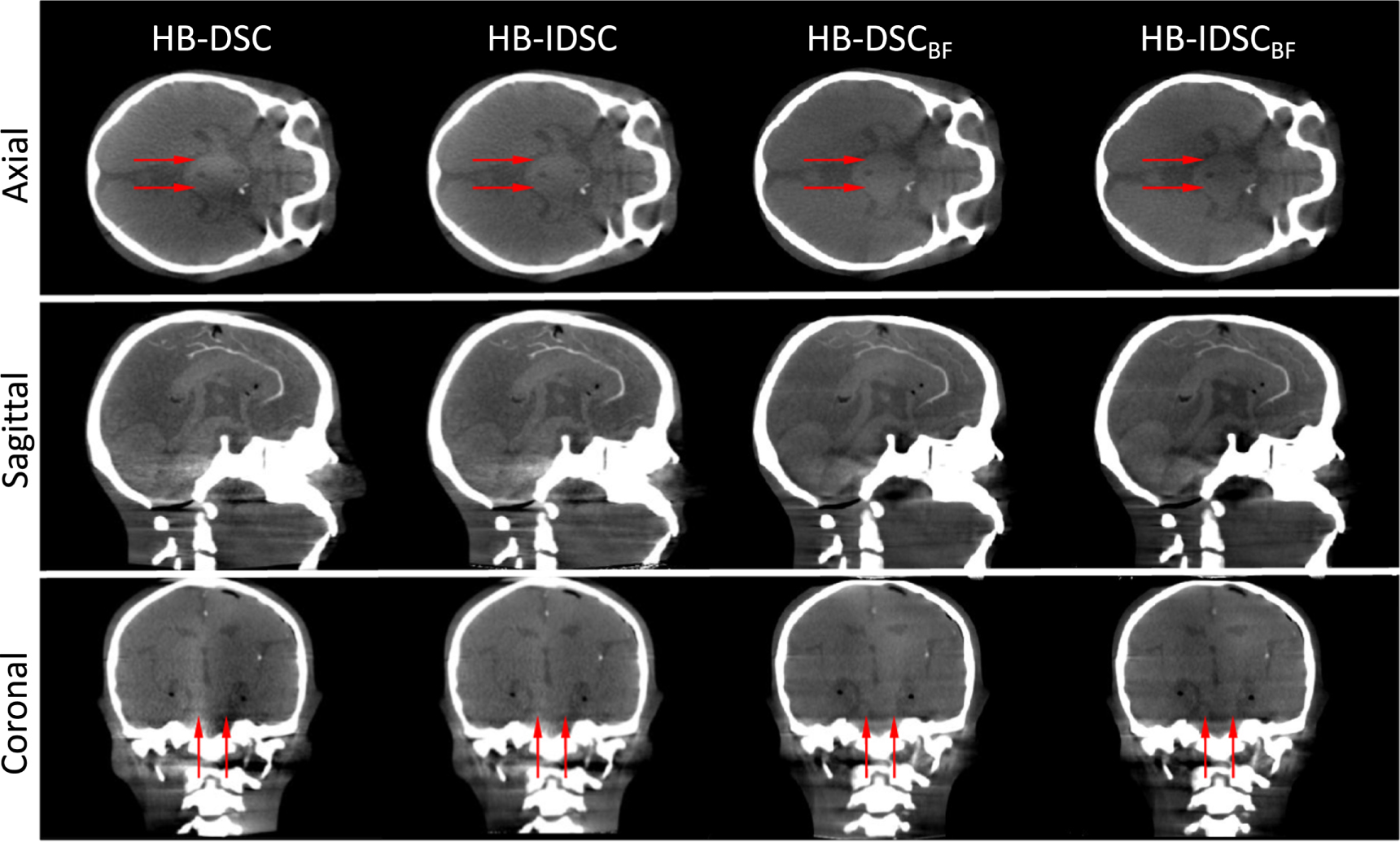 A practical and robust method for beam blocker-based cone beam CT ...