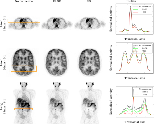 PET scatter estimation using deep learning U-Net architecture - IOPscience