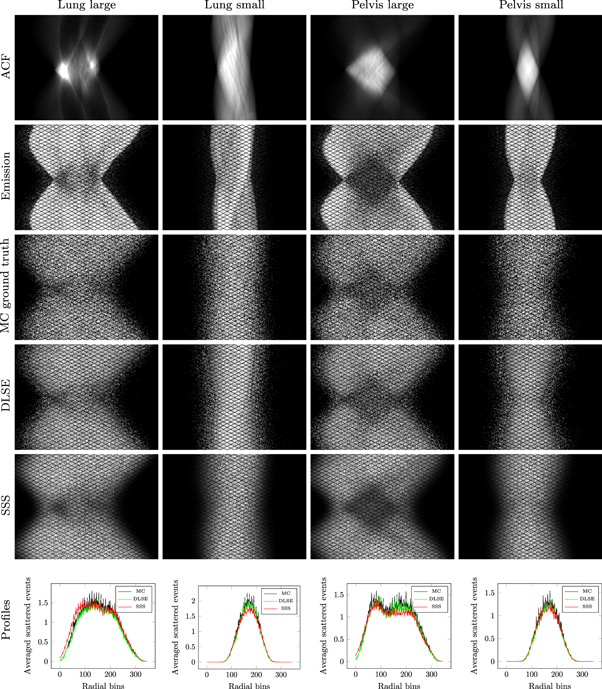 PET scatter estimation using deep learning U-Net architecture - IOPscience