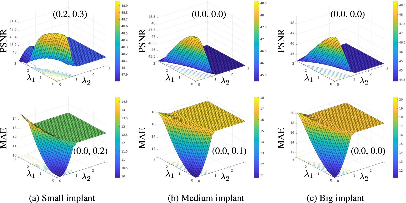 Physics-informed sinogram completion for metal artifact reduction in CT ...