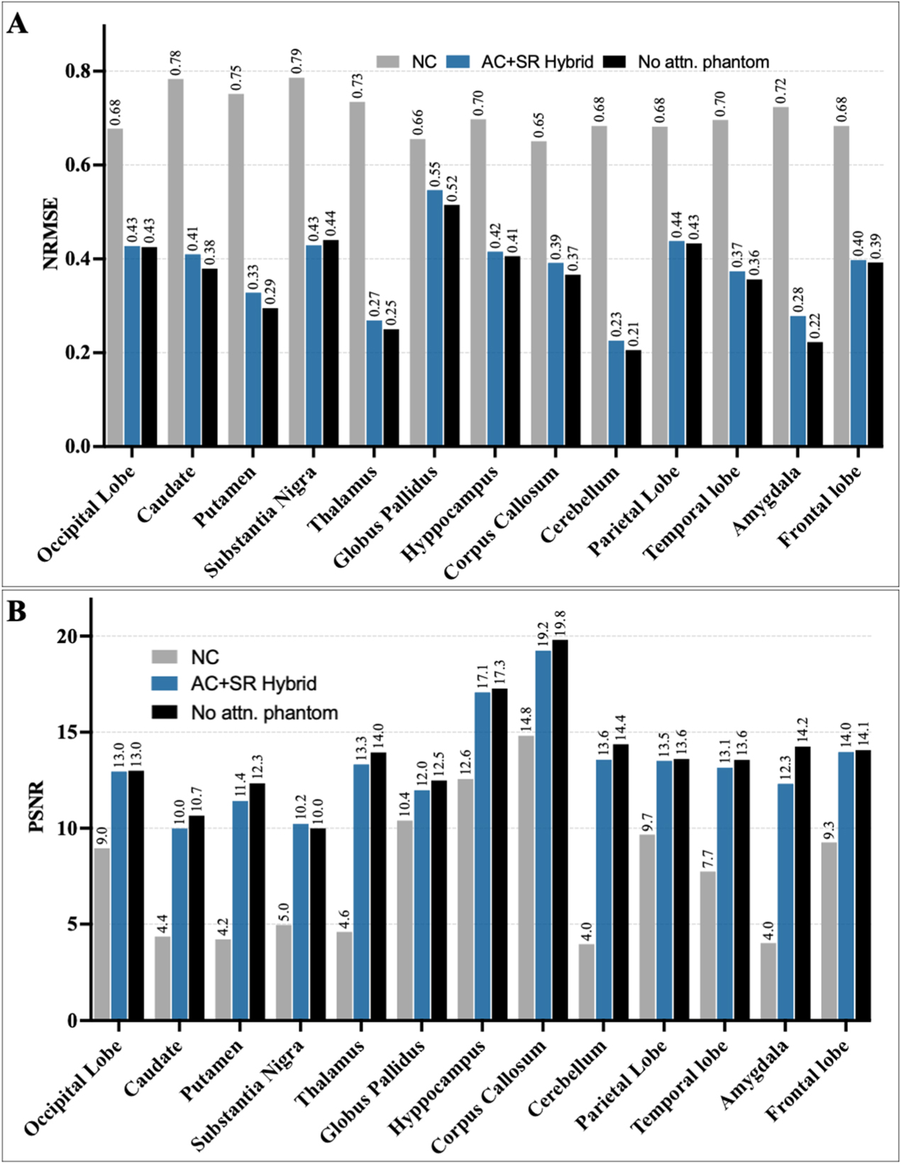 Mesh modeling of system geometry and anatomy phantoms for realistic ...