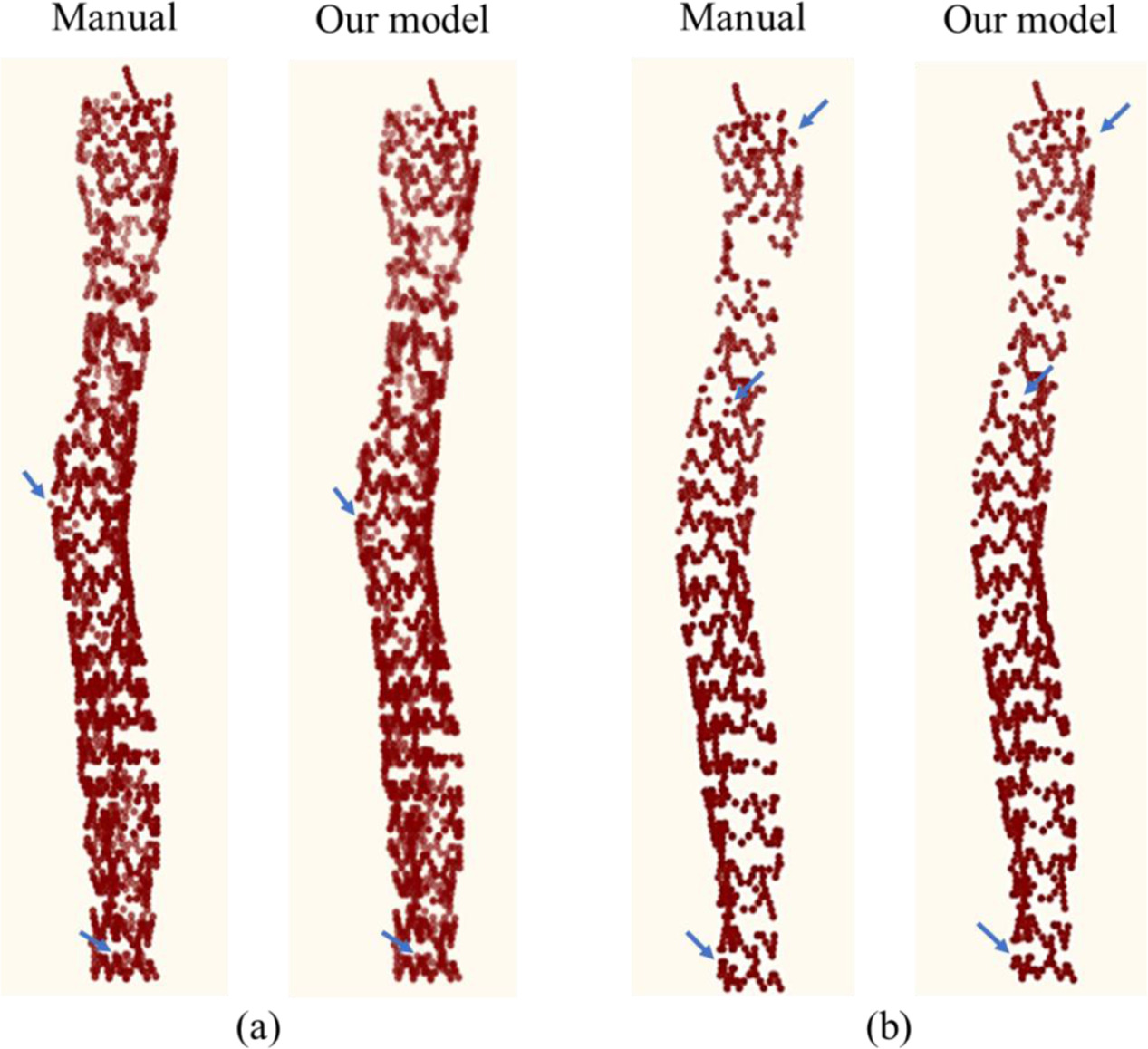 Automatic stent struts detection in optical coherence tomography based ...