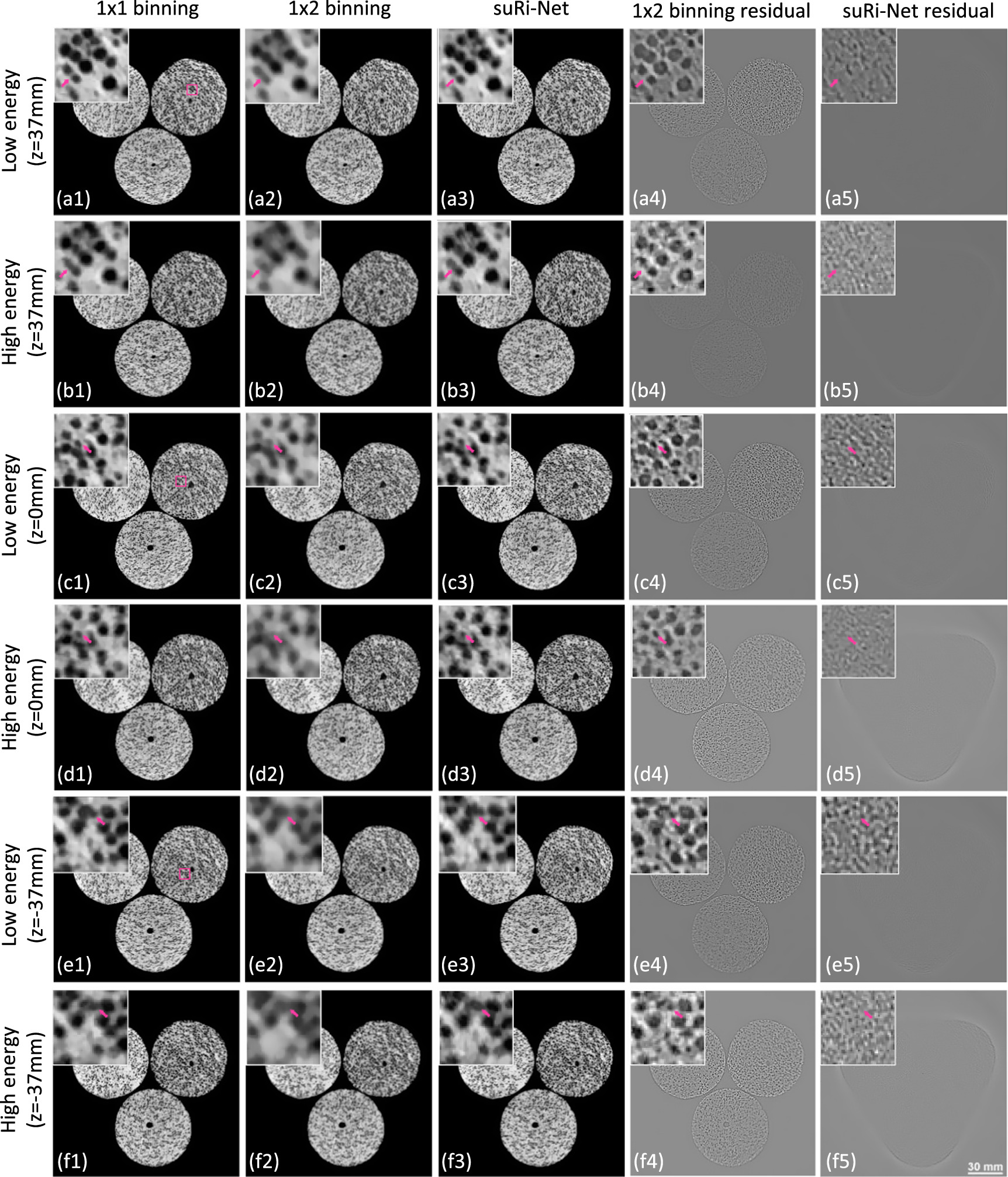 Cbct Resolution Super-resolution dual-layer CBCT imaging with model-guided deep ...