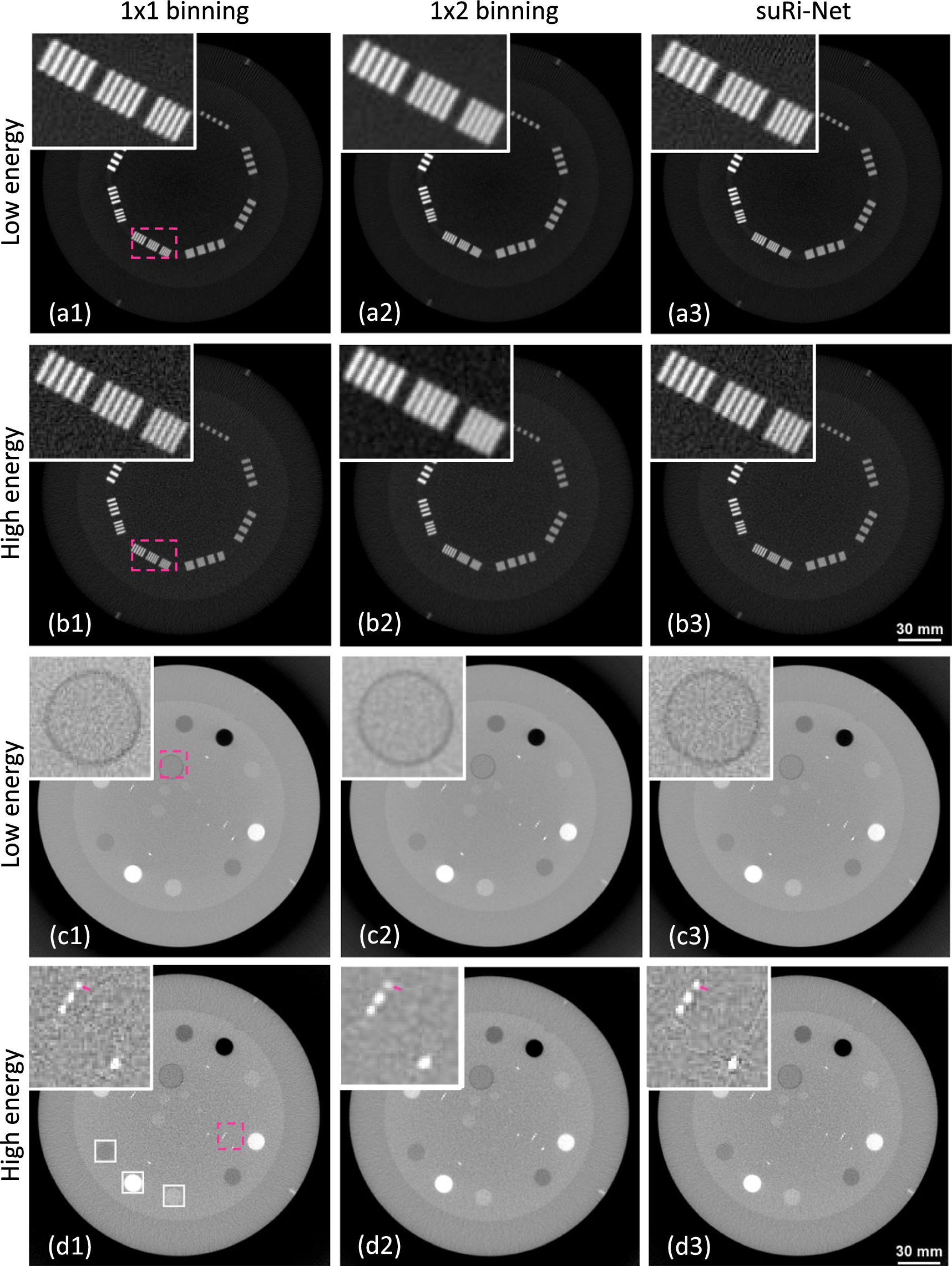 Cbct Resolution Super-resolution dual-layer CBCT imaging with model-guided deep ...
