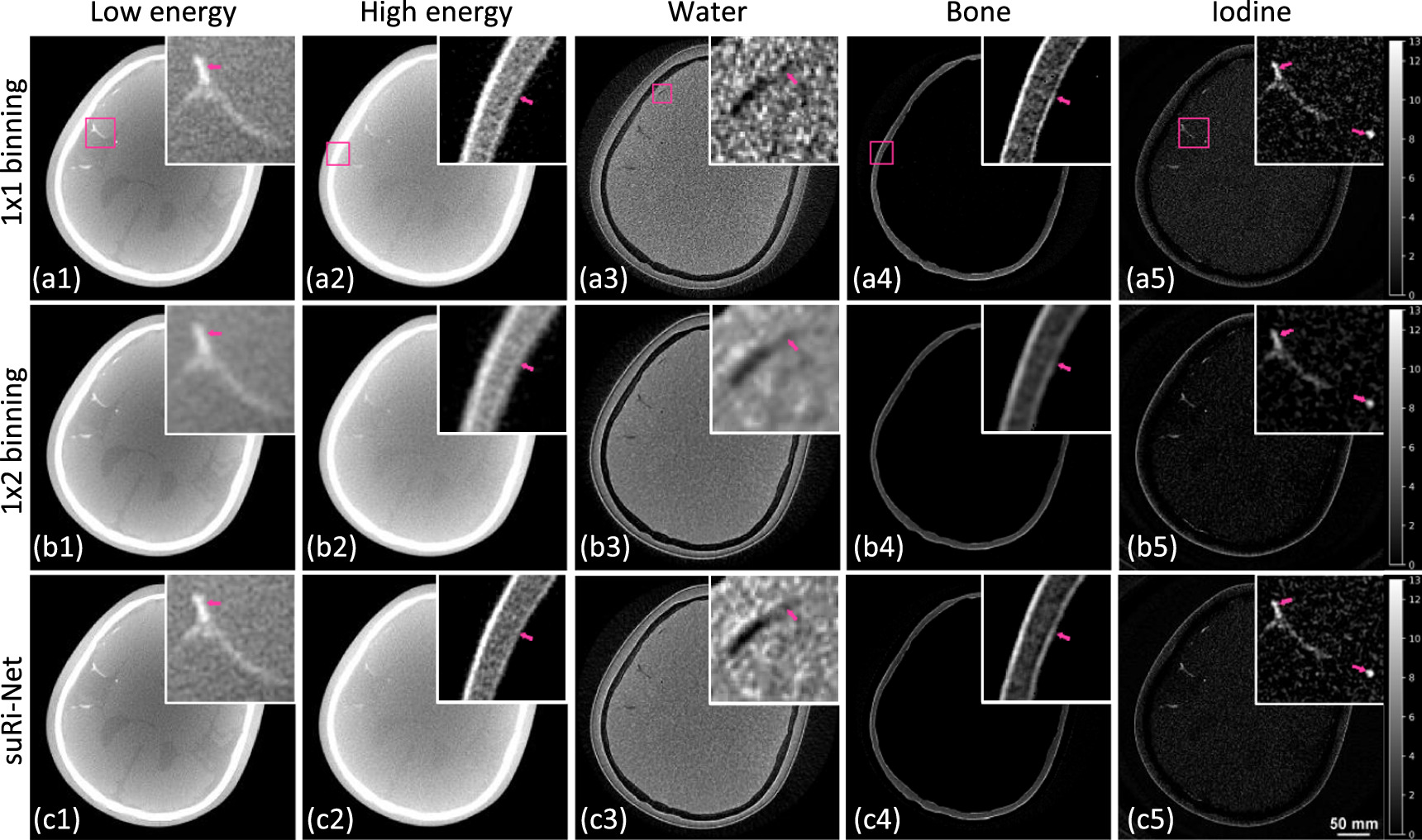 Cbct Resolution Super-resolution dual-layer CBCT imaging with model-guided deep ...