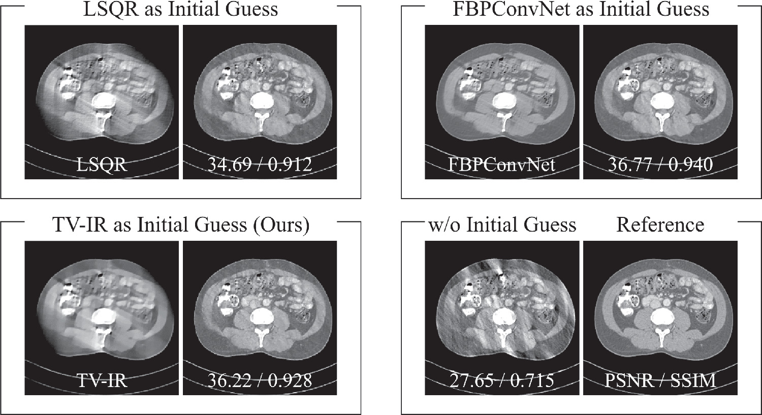 Iterative reconstruction for limited-angle CT using implicit neural ...