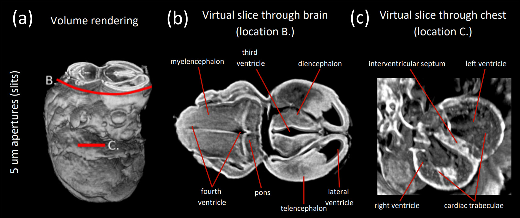 Phase contrast micro-CT with adjustable in-slice spatial resolution at ...