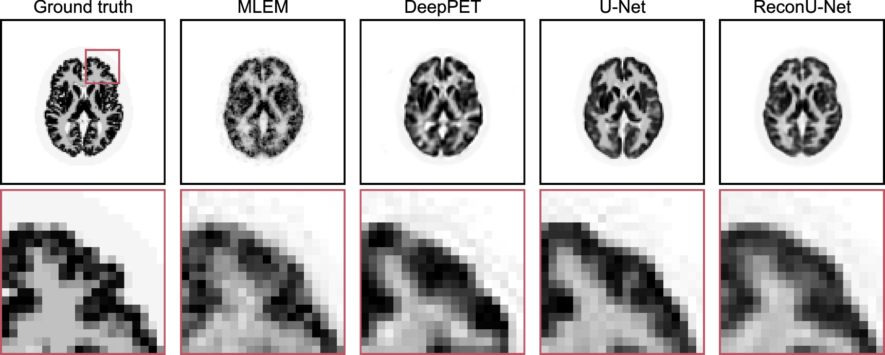 ReconU-Net: a direct PET image reconstruction using U-Net architecture ...
