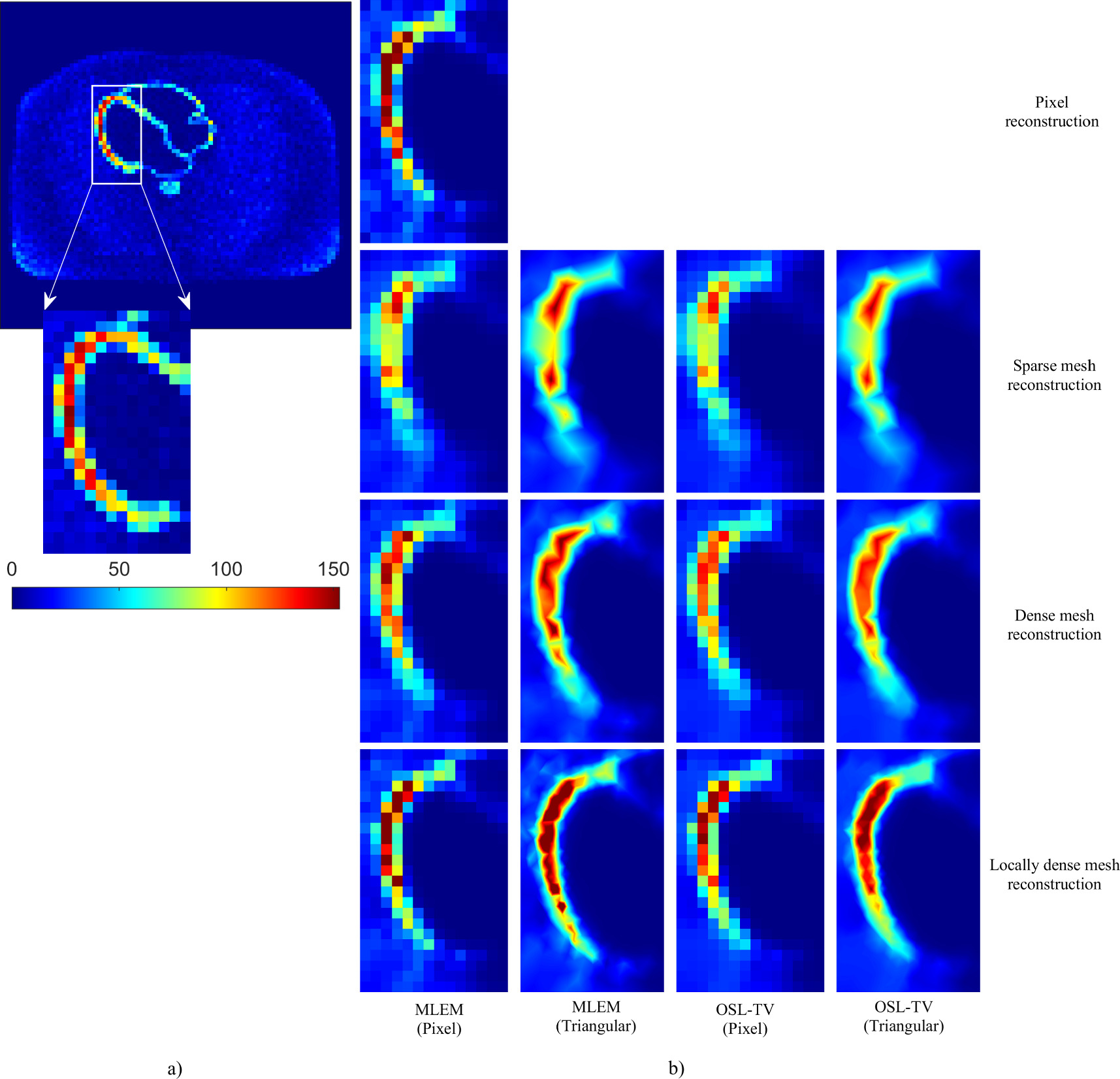 Anatomy-guided multi-resolution image reconstruction in PET - IOPscience