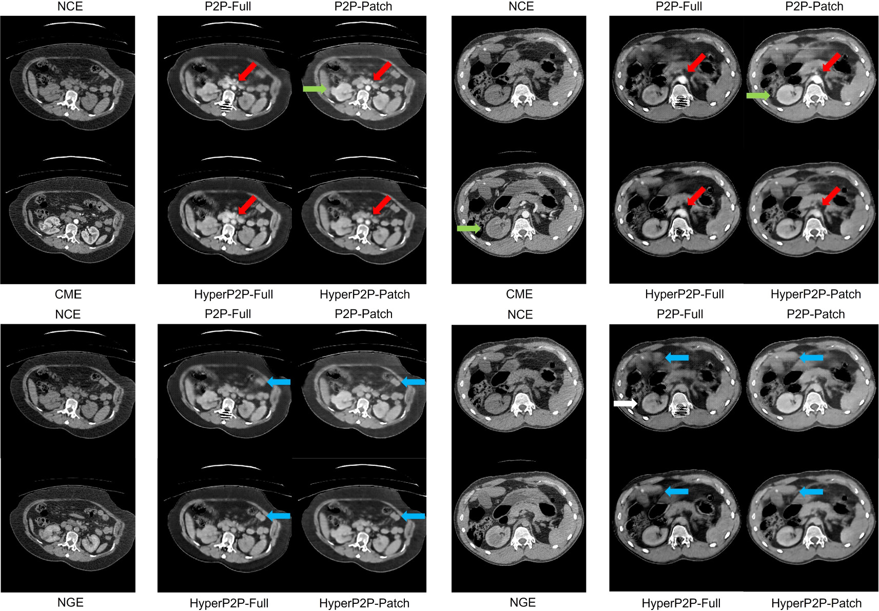 Time conditioning for arbitrary contrast phase generation in ...