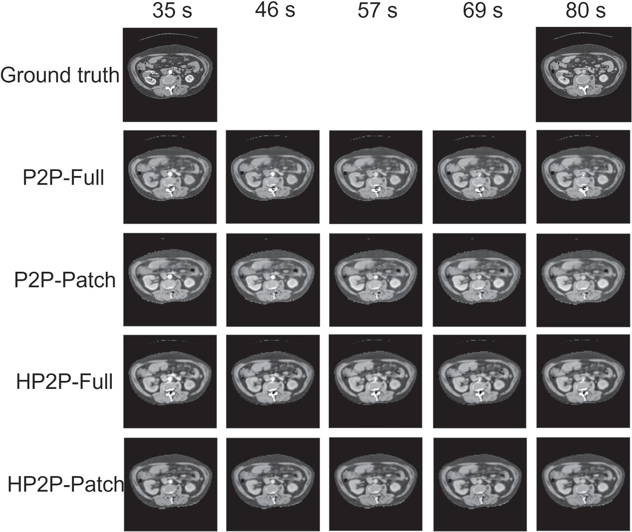 Time conditioning for arbitrary contrast phase generation in ...
