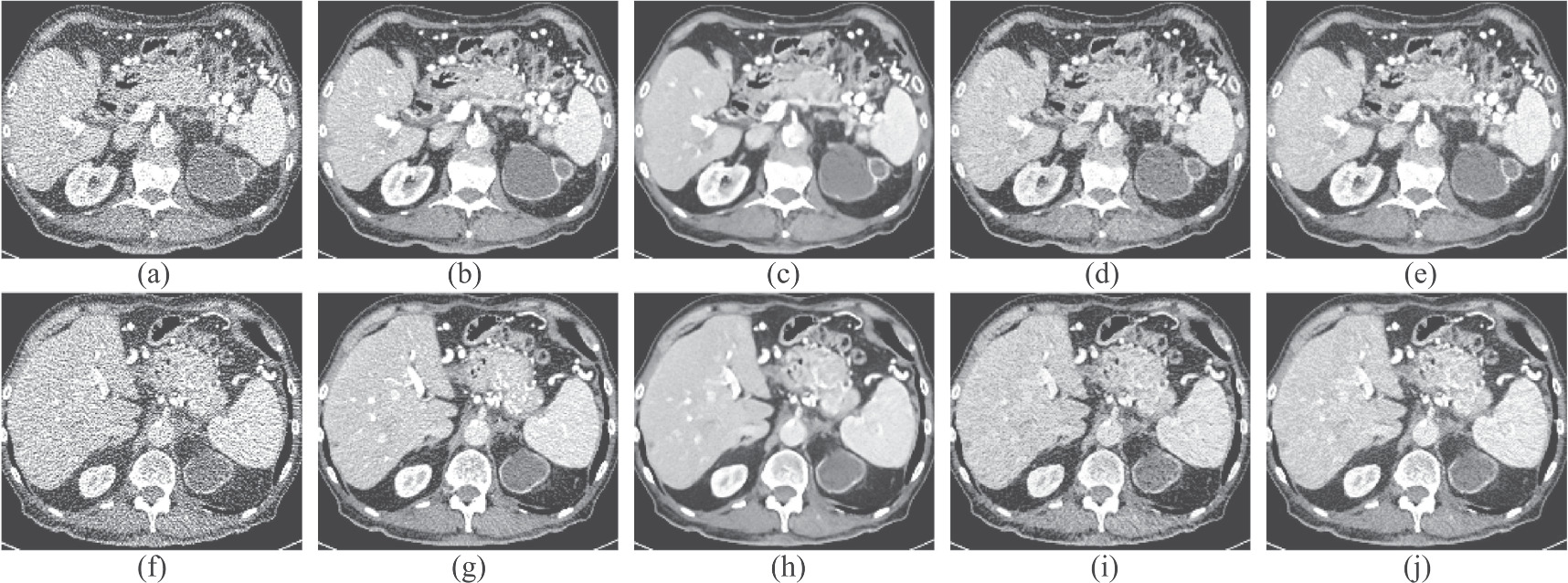 Texture-preserving low dose CT image denoising using Pearson divergence ...