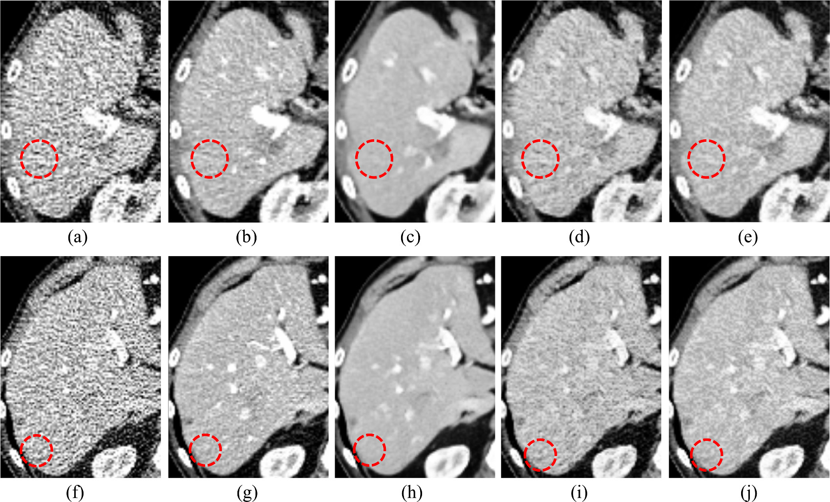 Texture-preserving low dose CT image denoising using Pearson divergence ...