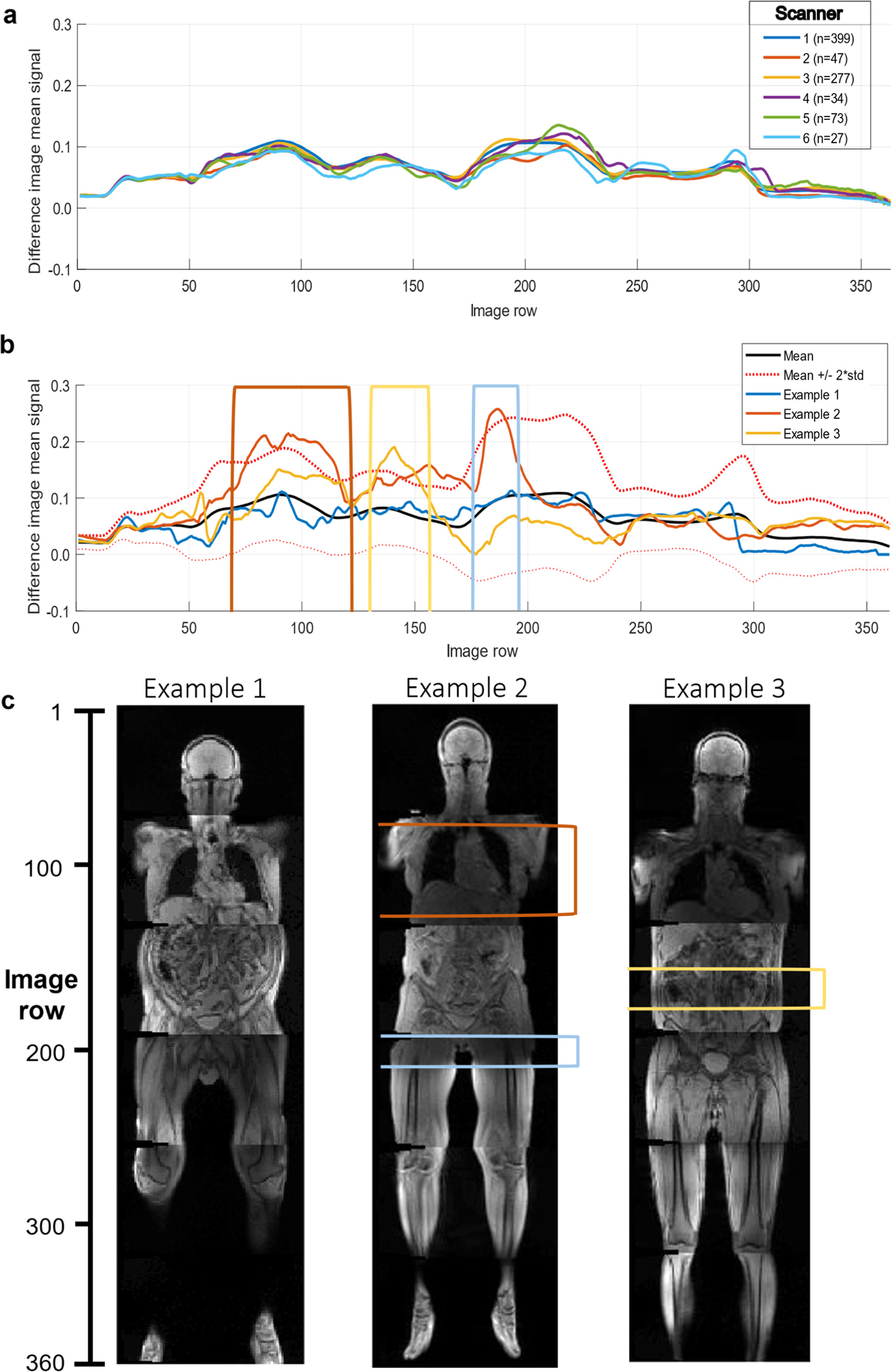A scan-specific quality control acquisition for clinical whole-body (WB ...