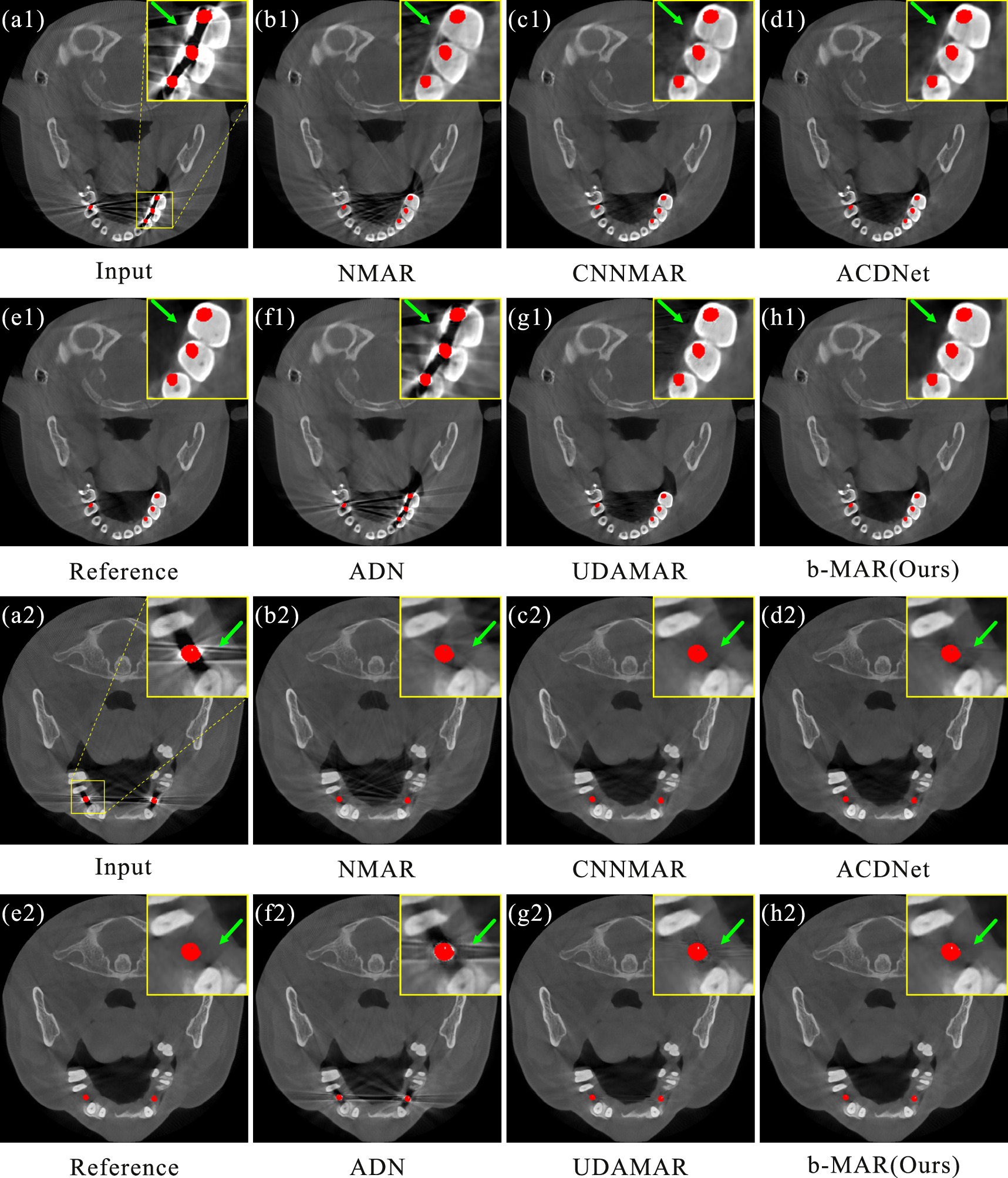 b-MAR: bidirectional artifact representations learning framework for ...