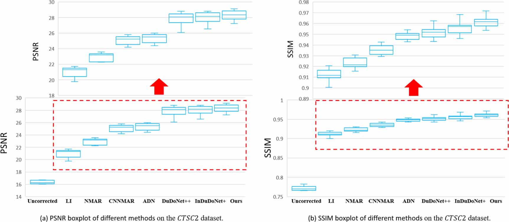 ReMAR: a preoperative CT angiography guided metal artifact reduction ...