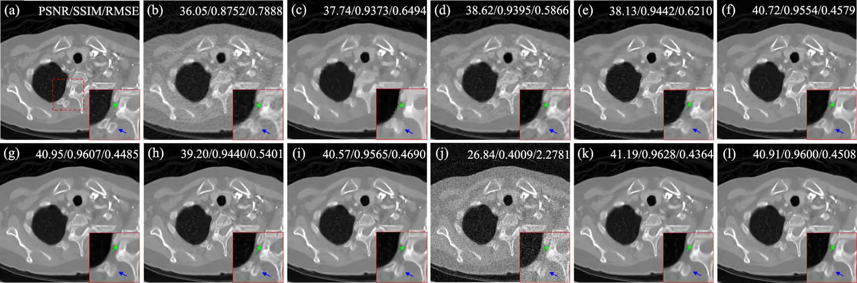 Structure-aware diffusion for low-dose CT imaging - IOPscience