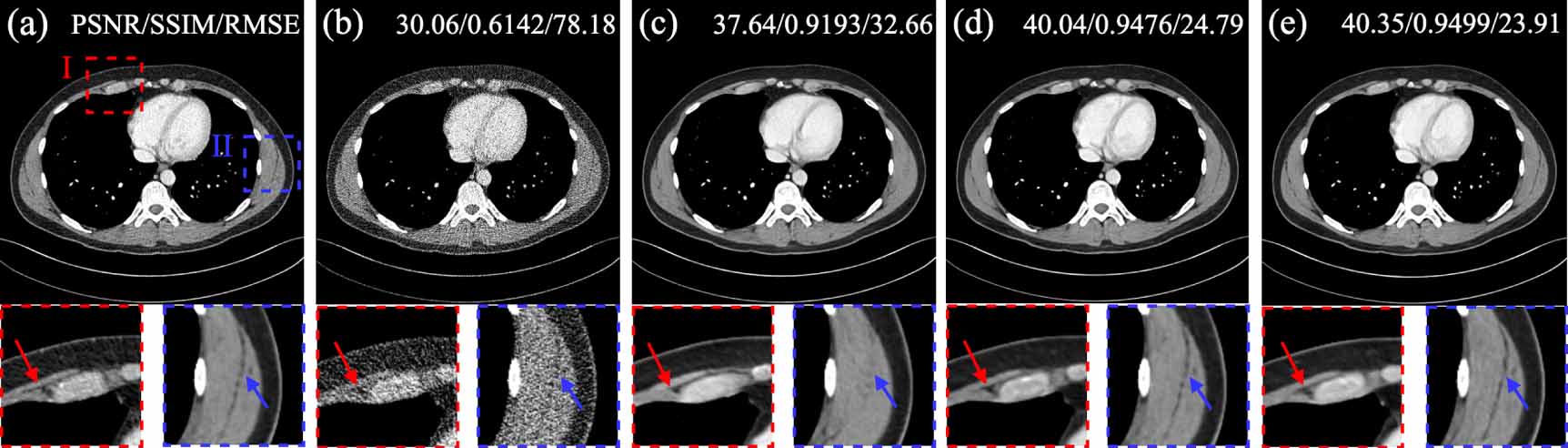 Structure-aware diffusion for low-dose CT imaging - IOPscience
