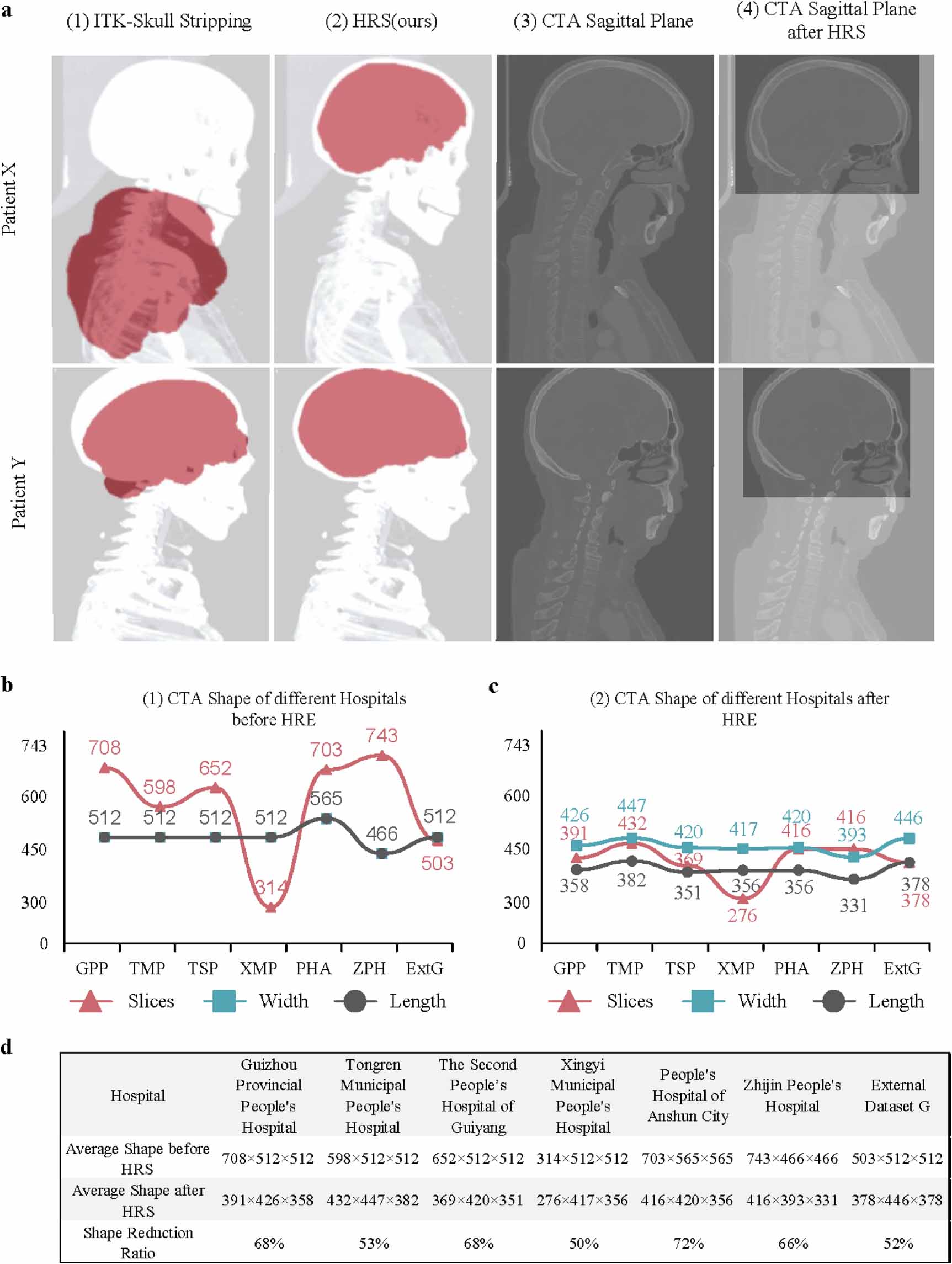 Deep learning for intracranial aneurysm segmentation using CT ...
