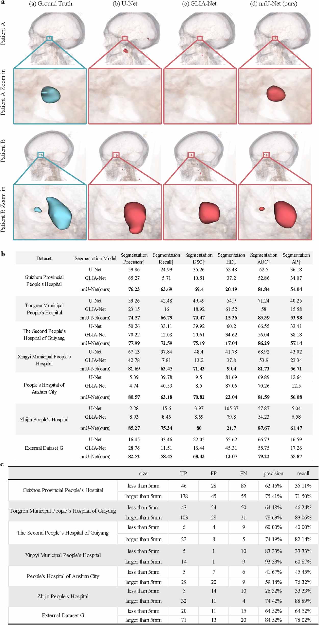 Deep learning for intracranial aneurysm segmentation using CT ...