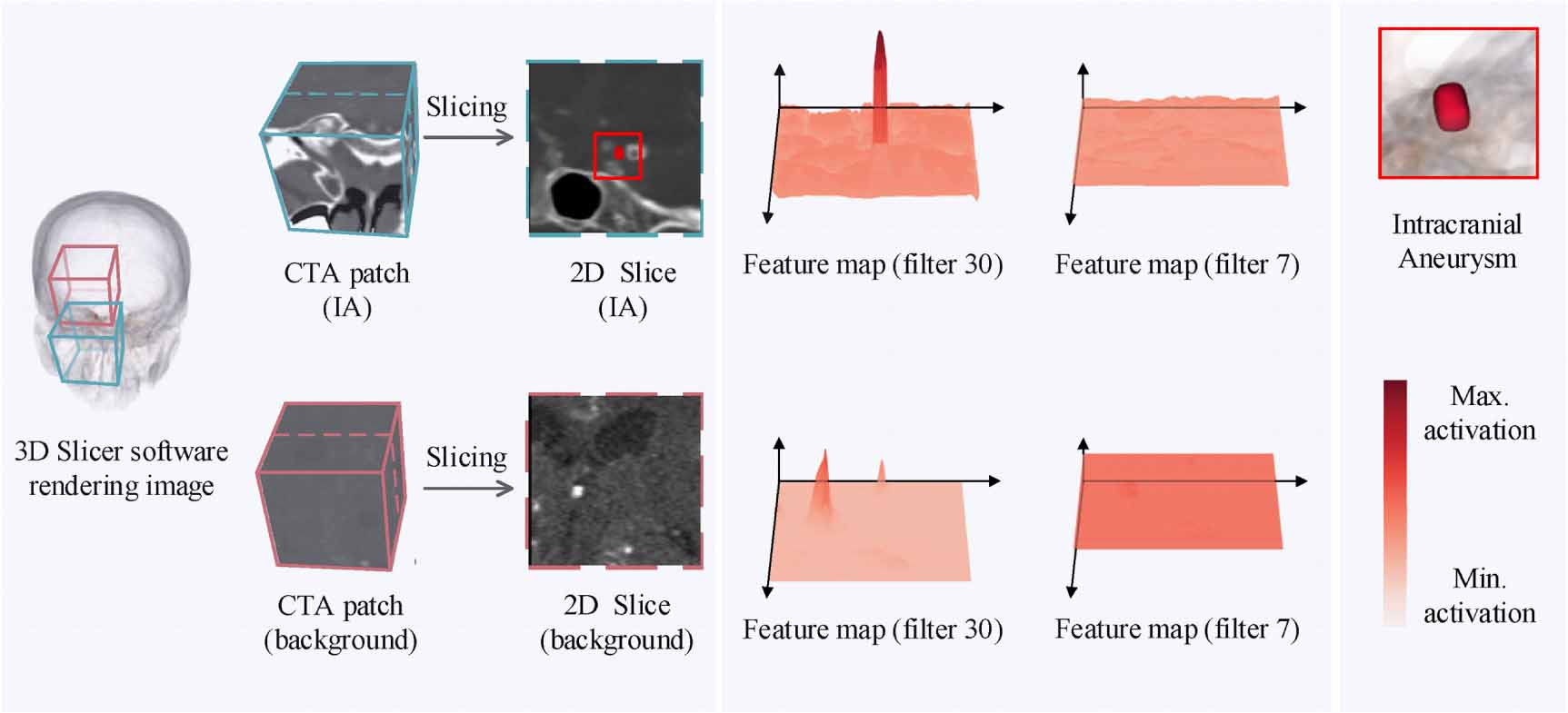 Deep learning for intracranial aneurysm segmentation using CT ...
