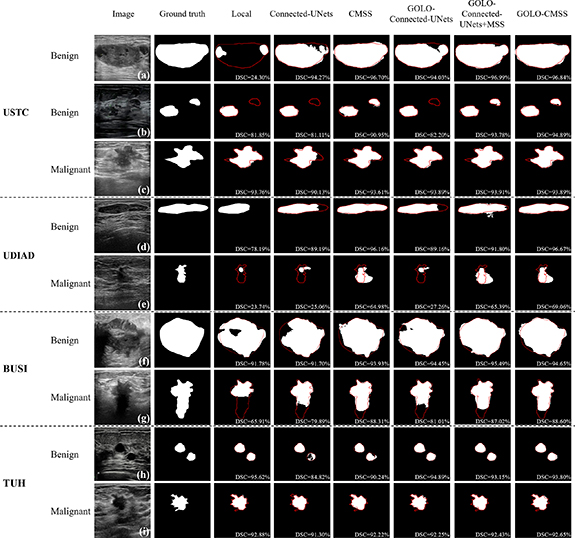 A deep learning-based method for the detection and segmentation of ...