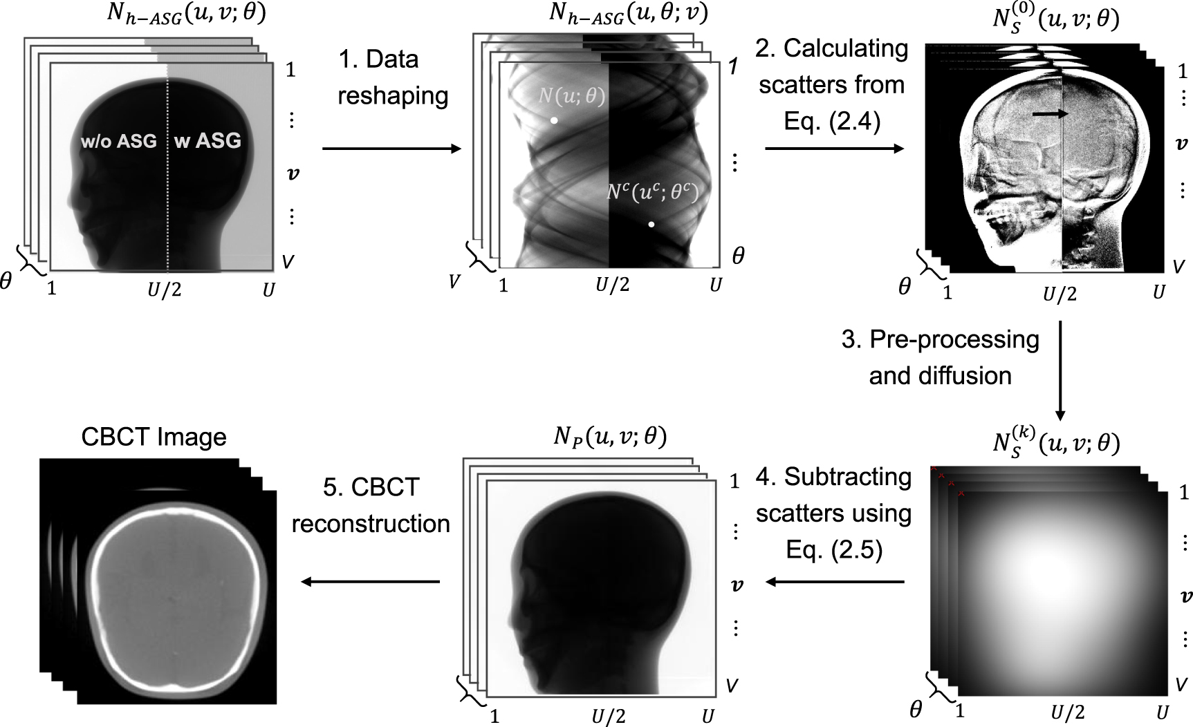 Correction of scatter in CBCT with a new grid design - IOPscience