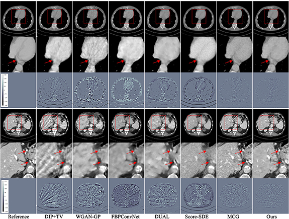 Linear diffusion noise boosted deep image prior for unsupervised sparse ...