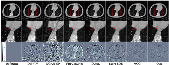Linear diffusion noise boosted deep image prior for unsupervised sparse ...
