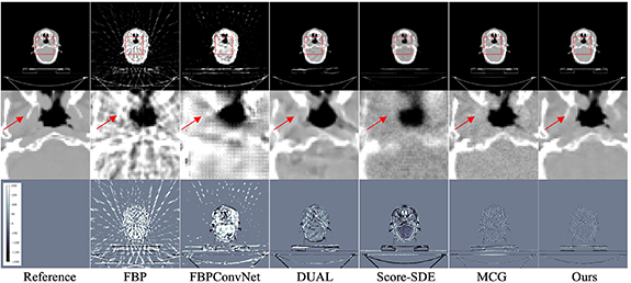 Linear diffusion noise boosted deep image prior for unsupervised sparse ...