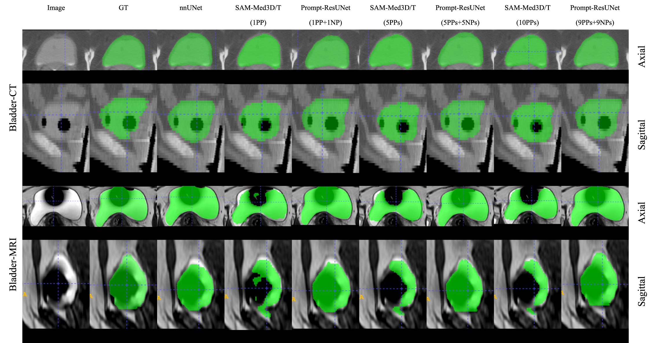 Deep learning-based segmentation for high-dose-rate brachytherapy in ...