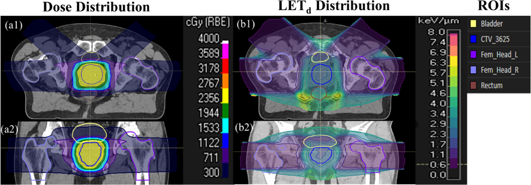 Deep learning-based synthetic dose-weighted LET map generation for ...