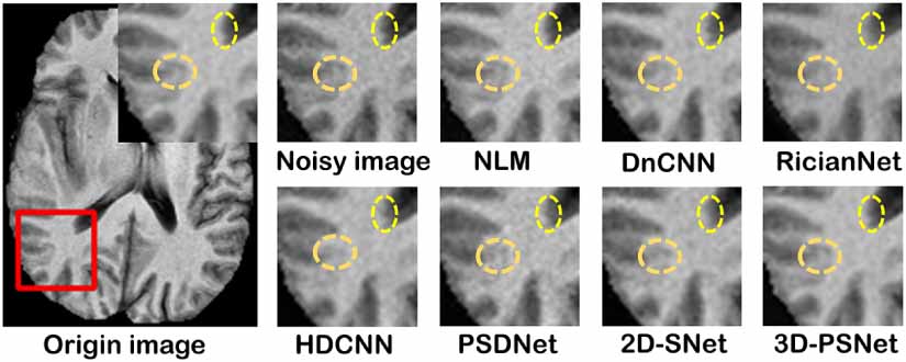 Global and local feature extraction based on convolutional neural ...