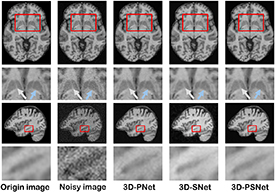 Global and local feature extraction based on convolutional neural ...