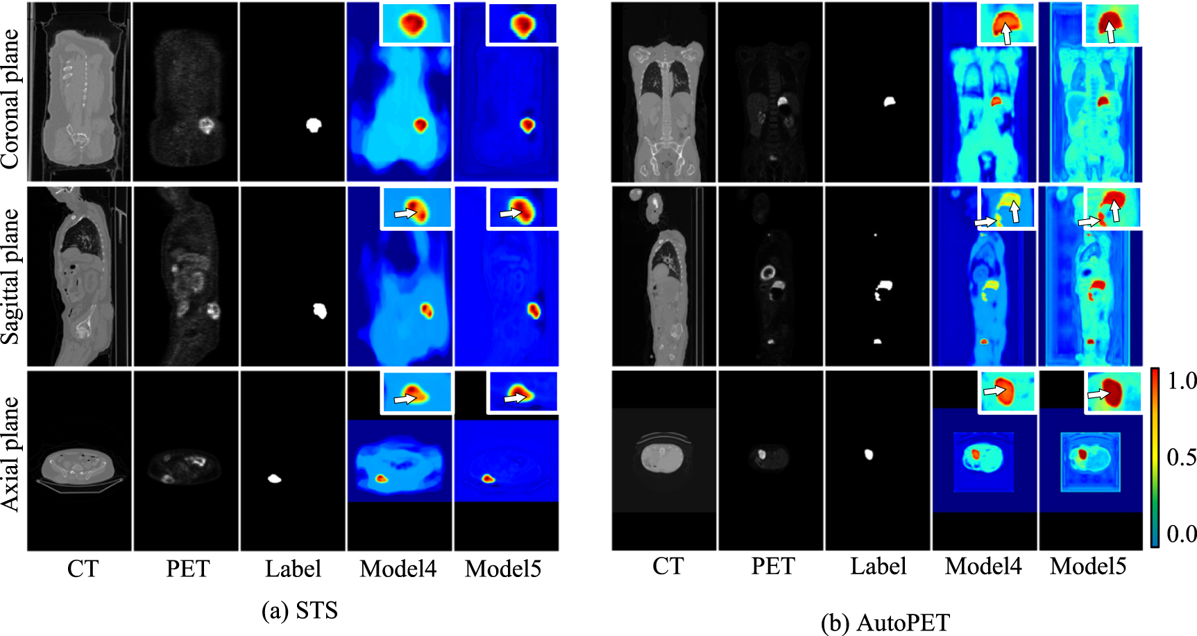 Joint segmentation of tumors in 3D PET-CT images with a network fusing ...