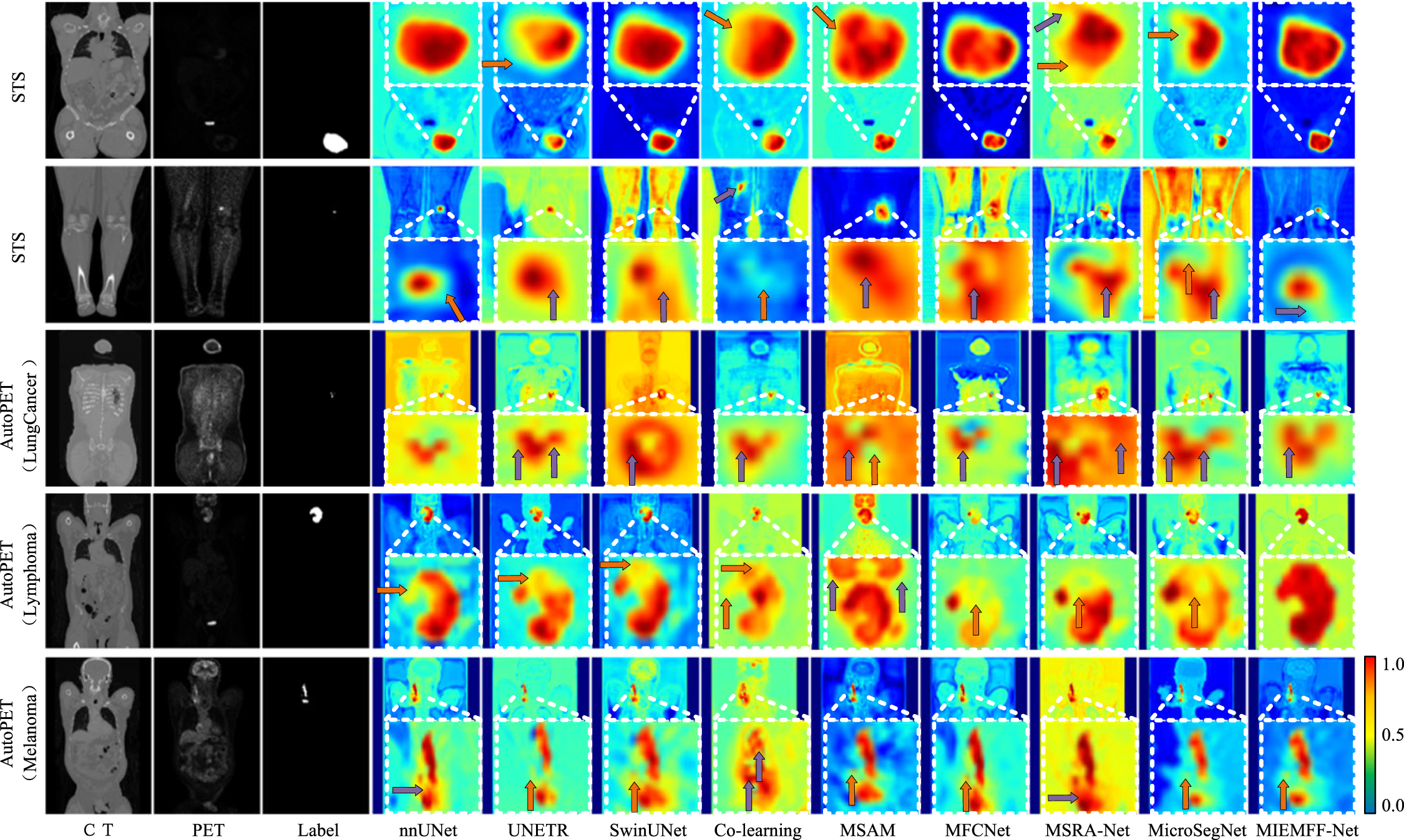 Joint segmentation of tumors in 3D PET-CT images with a network fusing ...