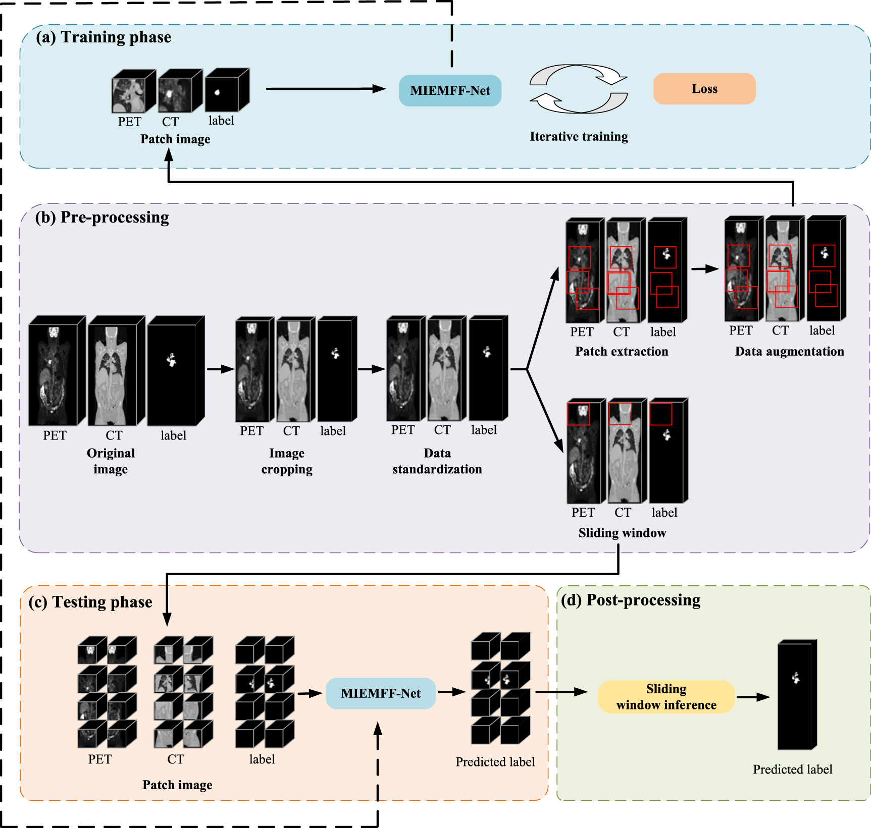 Joint segmentation of tumors in 3D PET-CT images with a network fusing ...
