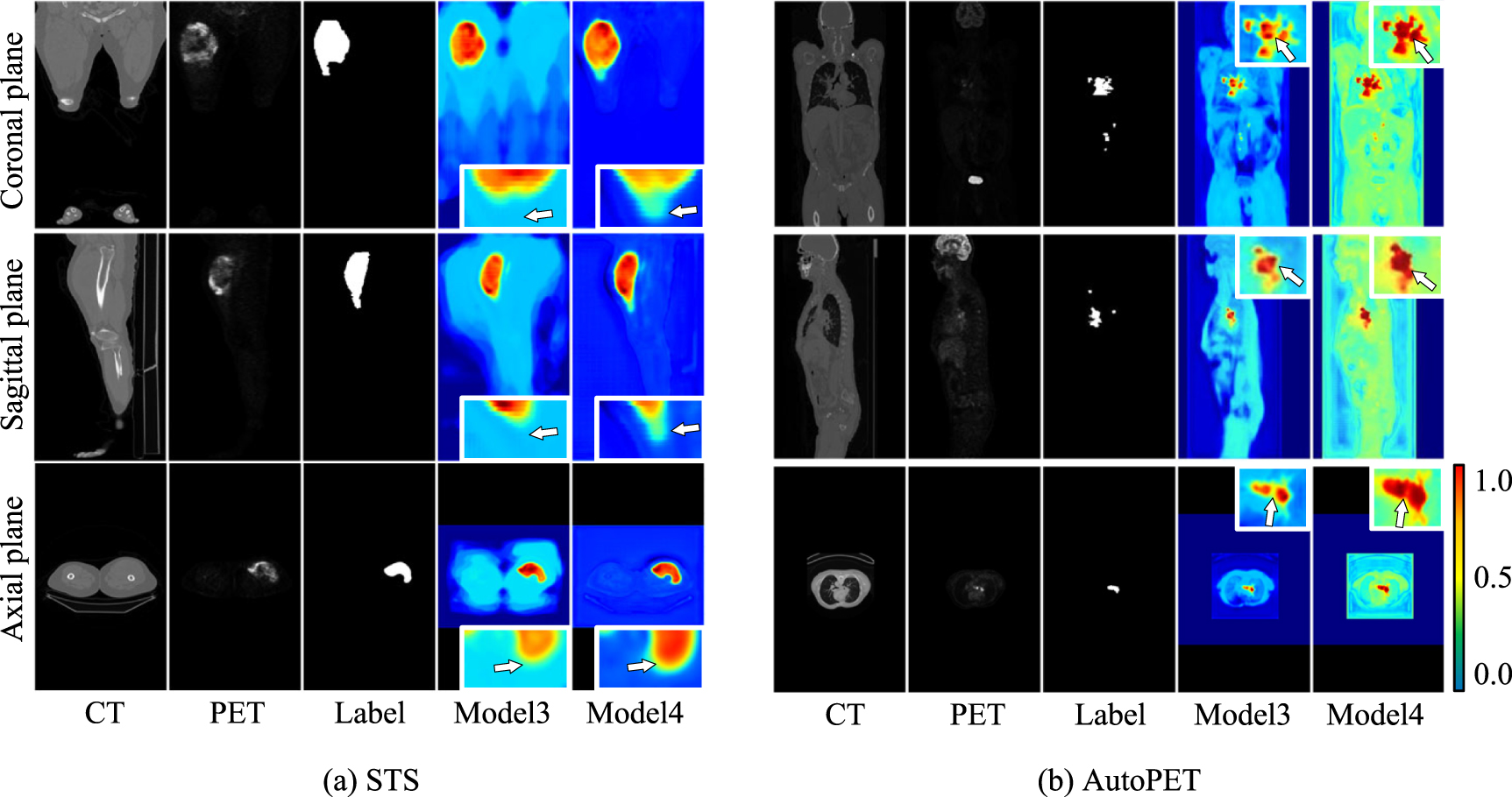 Joint segmentation of tumors in 3D PET-CT images with a network fusing ...