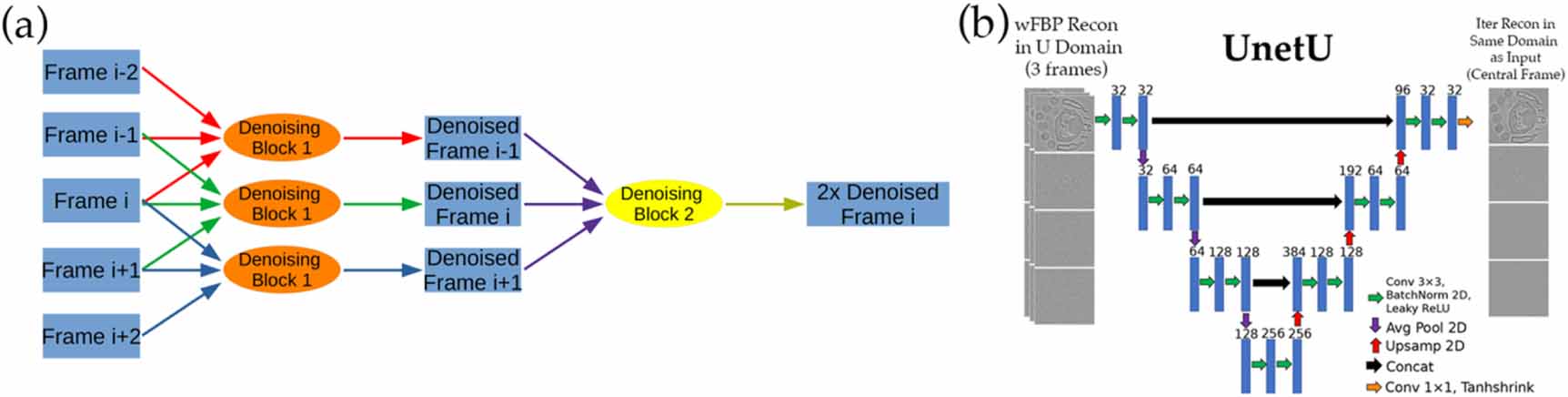 Investigating deep learning strategies for fast denoising of 5D cardiac ...