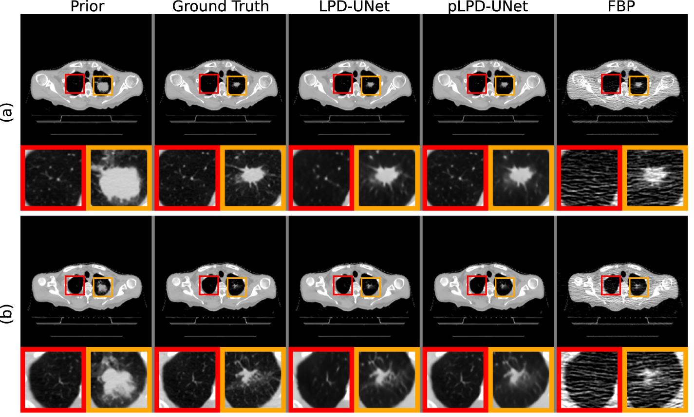 Prior-image-based low-dose CT reconstruction for adaptive radiation ...