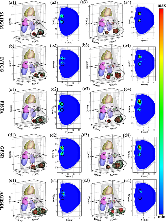Sparse-Laplace hybrid graph manifold method for fluorescence molecular ...