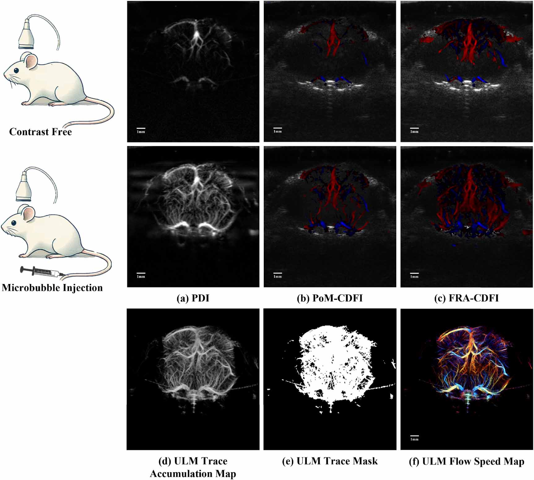 Improving microvascular sensitivity of color Doppler using phase mask ...