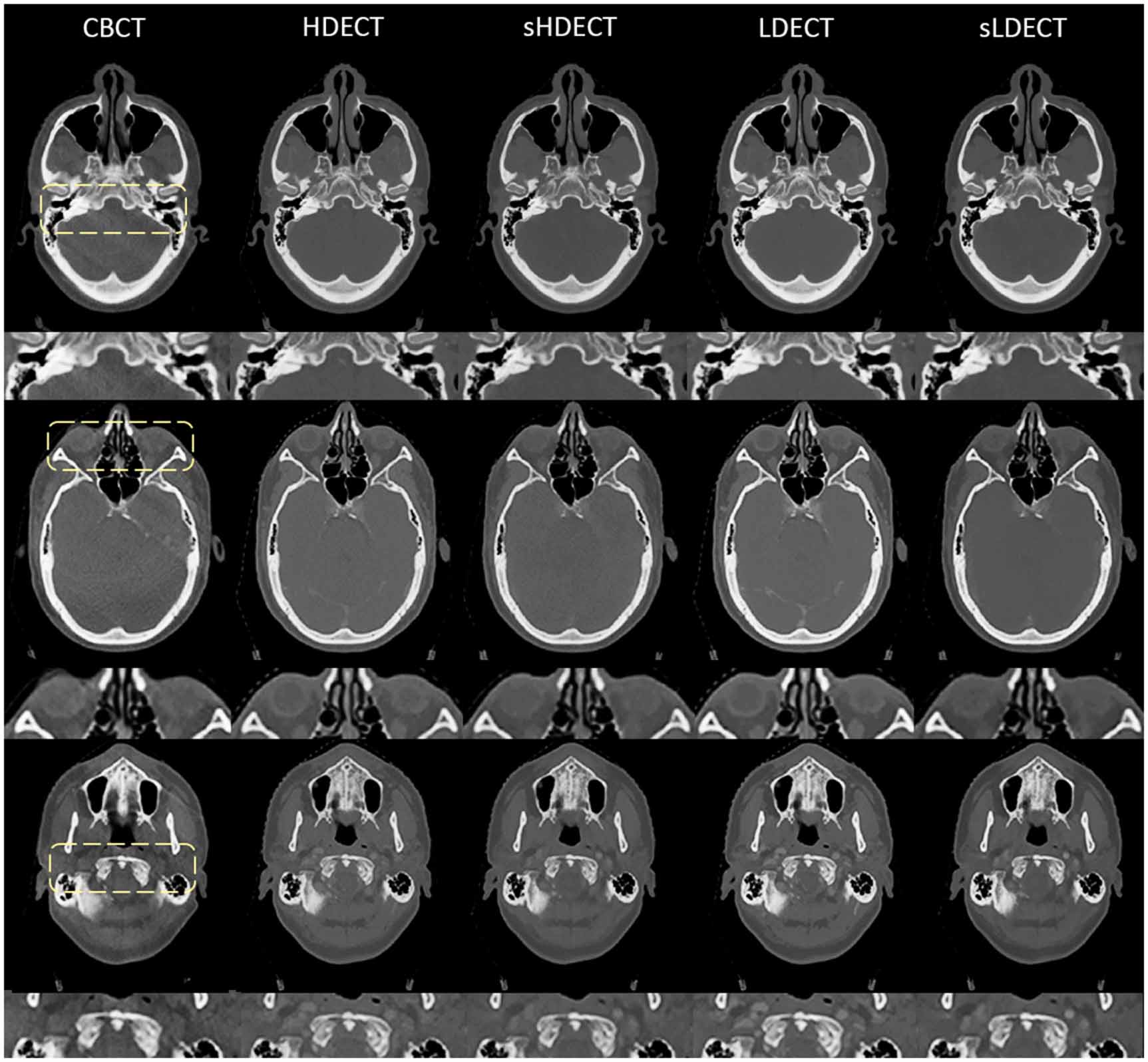 Ccot Radiographic Exploring dual energy CT synthesis in CBCT-based adaptive radiotherapy ...