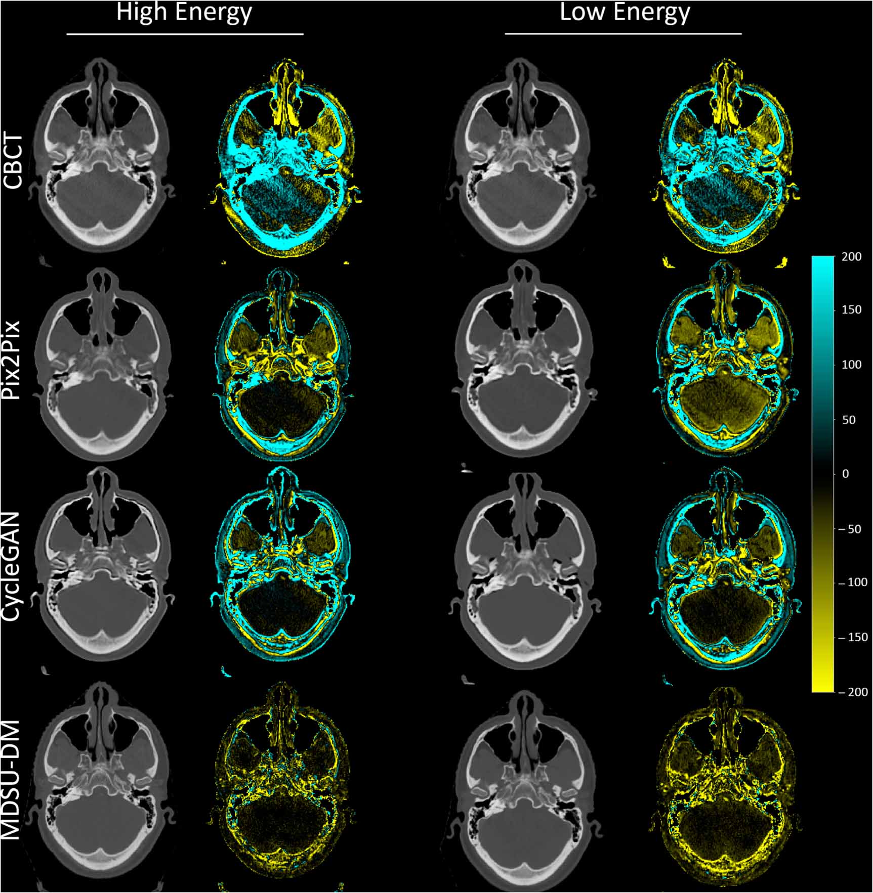 Exploring dual energy CT synthesis in CBCT-based adaptive radiotherapy ...