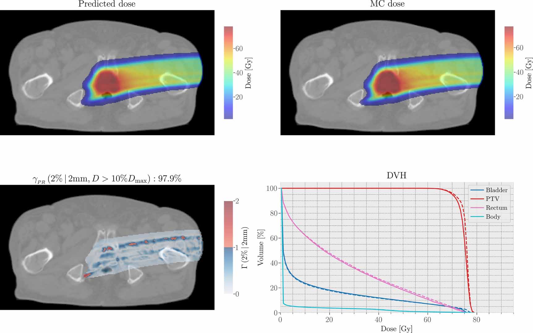 Proton dose calculation with LSTM networks in presence of a magnetic ...